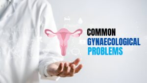 Common Digestive Disorders