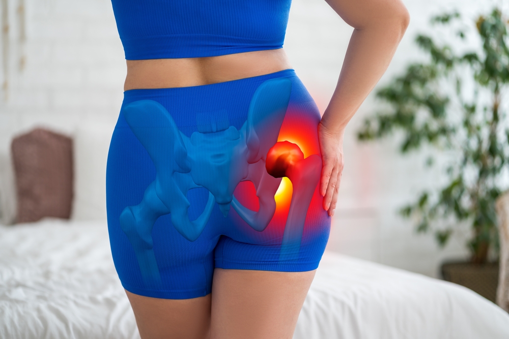 Hip,Dysplasia,,Joint,Inflammation,,Woman,Suffering,From,Pain,At,Home,