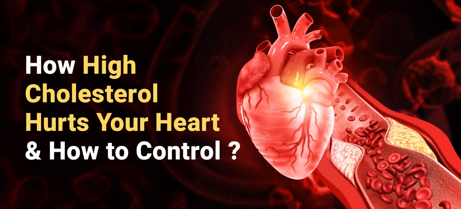 How High Cholesterol Hurts Your Heart and How to Control It